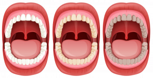 سلامتی دندان